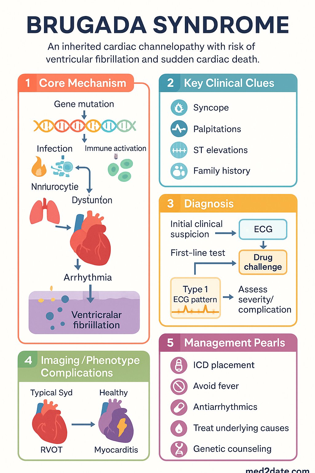 Brugada Syndrome clinical infographic — pathophysiology, clinical clues, diagnosis, imaging, and management