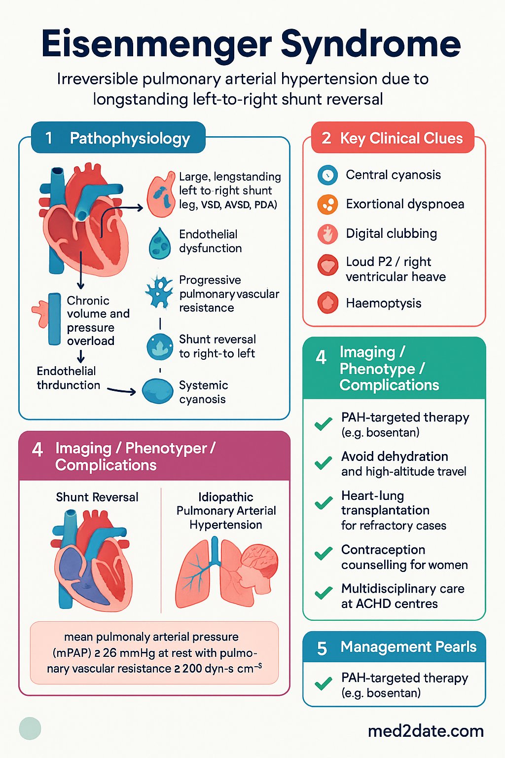 Eisenmenger Syndrome clinical infographic — pathophysiology, clinical clues, diagnosis, imaging, and management