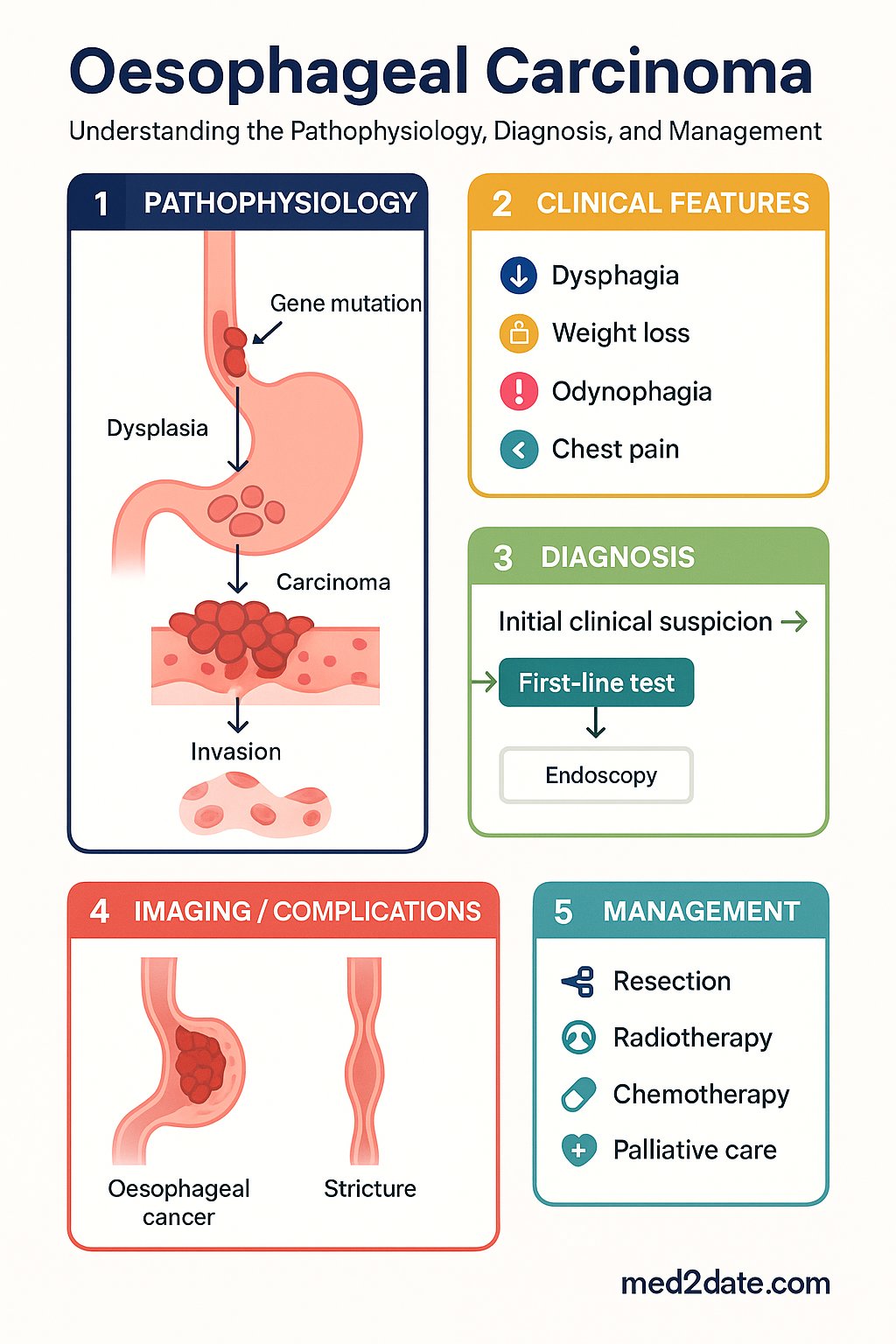Oesophageal Carcinoma clinical infographic — pathophysiology, clinical clues, diagnosis, imaging, and management